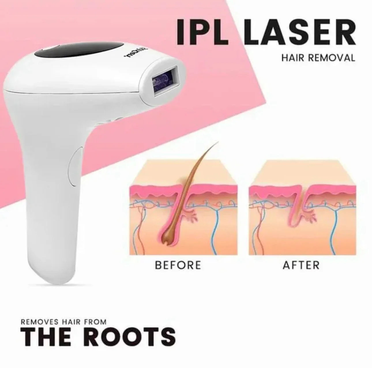 Professional IPL Laser Hair Removal